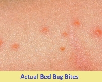 pest control for bed bugs 52